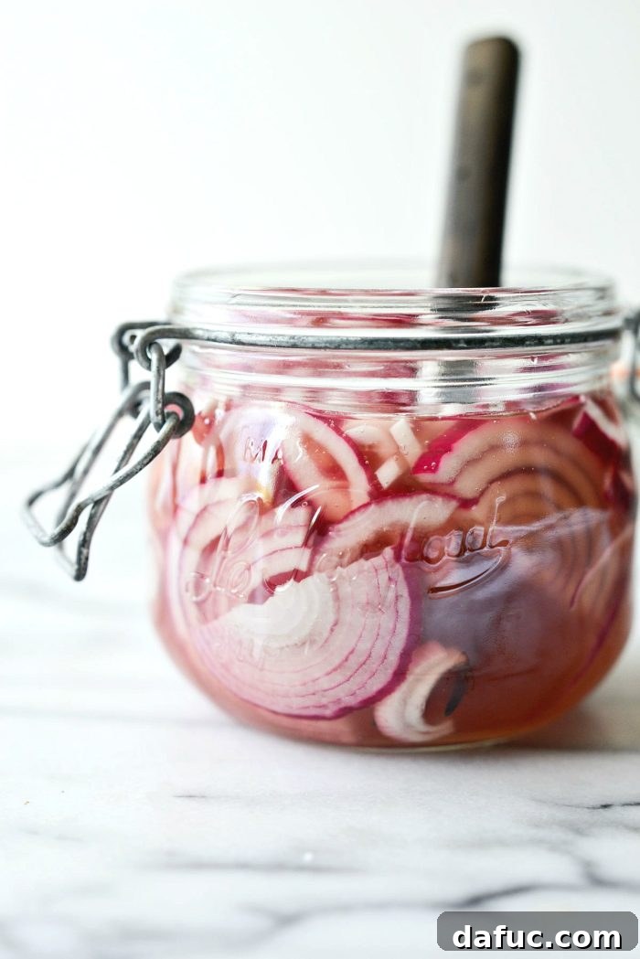 Zesty Quick Pickled Red Onions 12 Quick pickled red onions stored in a sealed glass jar